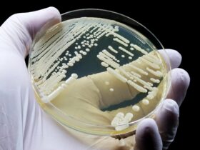 First-ever Candida Auris outbreak hits Washington | Credits: Google Images