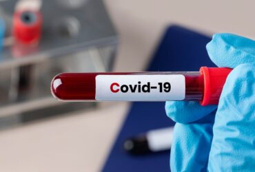 Rising cases of long COVID spark concerns in the US