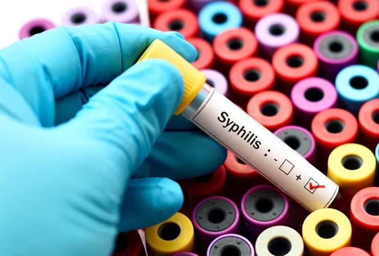 Syphilis Outbreak Strikes the US. | Credits: JARUN011 / GETTY IMAGES